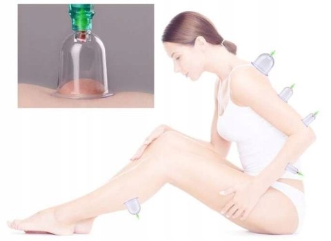 Bańki Chińskie Próżniowe Bezogniowe Cellulit 12szt Bańki Chińskie Próżniowe Bezogniowe Cellulit 12szt